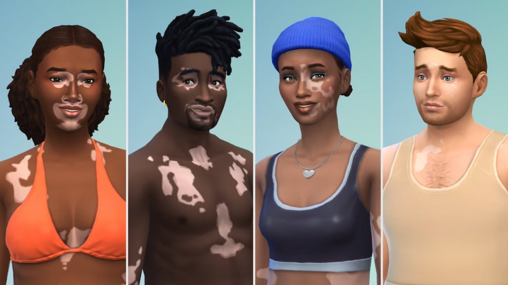 Vitiligo Skins in Sims 4